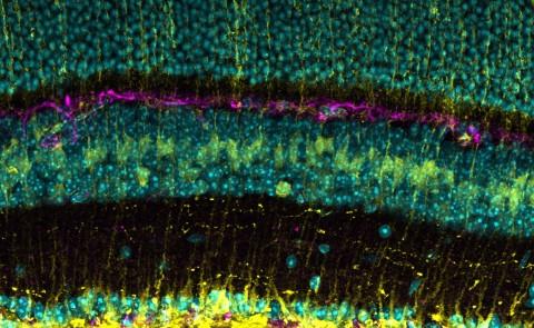 A microscope image of a mouse retina